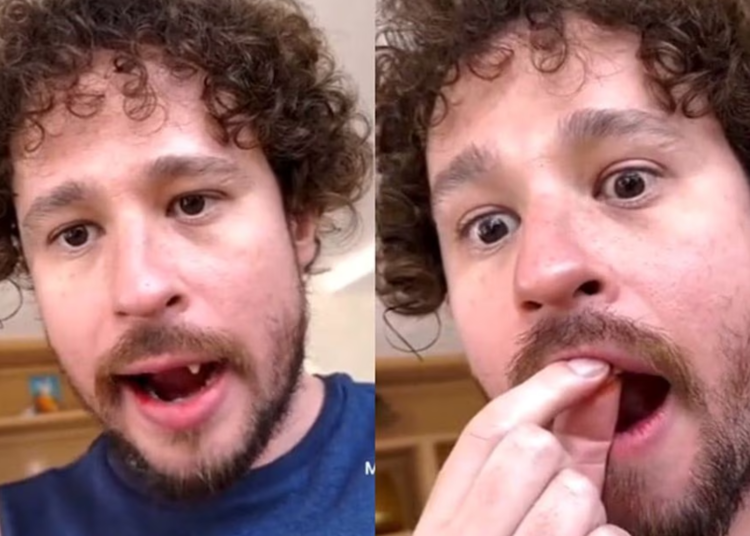(VÍDEO) «Inesperado percance en vivo: Luisito Comunica pierde dos dientes durante transmisión en Instagram»