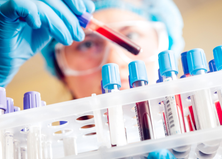 Mayor riesgo de cáncer en la Generación X y millennials, revela estudio